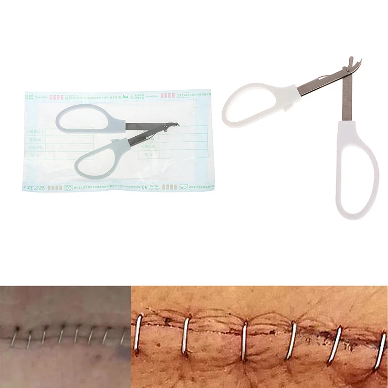 Staple Remover For Skin Staples
